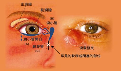 眼眶病,希瑪瑞視眼科,上海眼科醫(yī)院 眼眶病,希瑪瑞視眼科,上海眼科醫(yī)院