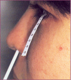 眼表眼角膜,?，斎鹨曆劭?上海眼科醫院