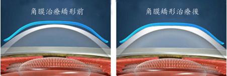 醫學驗光配鏡,?，斎鹨曆劭?上海眼科醫院