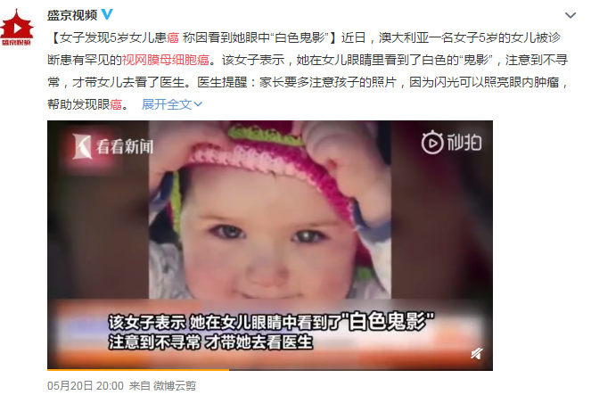 眼眶病,?，斎鹨曆劭?上海眼科醫院