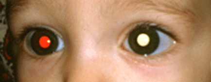 眼眶病,?，斎鹨曆劭?上海眼科醫院