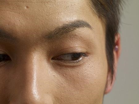 小兒眼病,希瑪瑞視眼科,上海眼科醫(yī)院