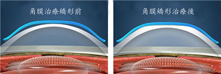 小兒眼病,?，斎鹨曆劭?上海眼科醫(yī)院