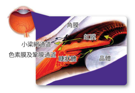 青光眼,希瑪瑞視眼科,上海眼科醫院 青光眼,希瑪瑞視眼科,上海眼科醫院