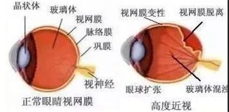 玻璃體視網膜,希瑪瑞視眼科,上海眼科醫院 玻璃體視網膜,希瑪瑞視眼科,上海眼科醫院