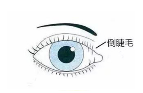 眼表眼角膜,希瑪瑞視眼科,上海眼科醫院 眼表眼角膜,希瑪瑞視眼科,上海眼科醫院