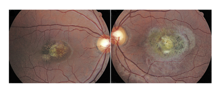 小兒眼病,希瑪瑞視眼科,上海眼科醫(yī)院 小兒眼病,希瑪瑞視眼科,上海眼科醫(yī)院