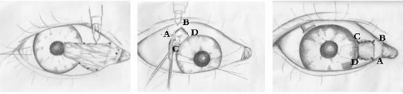 眼表眼角膜,?，斎鹨曆劭?上海眼科醫(yī)院
