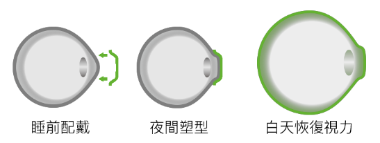 醫學驗光配鏡,希瑪瑞視眼科,上海眼科醫院