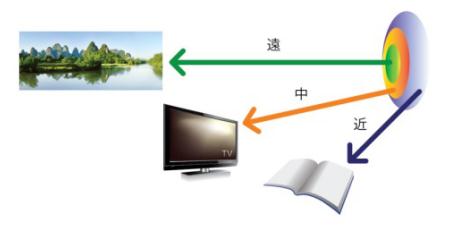 白內障,希瑪瑞視眼科,上海眼科醫院