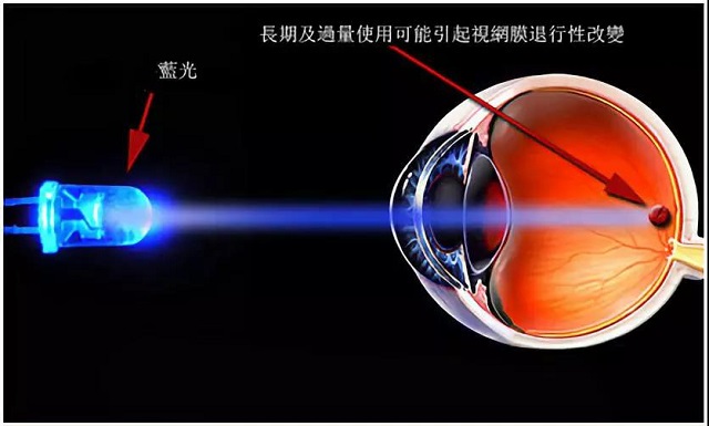 屈光矯視,希瑪瑞視眼科,上海眼科醫院