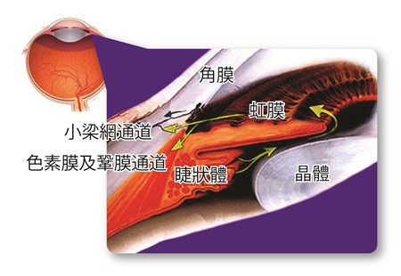 青光眼,希瑪瑞視眼科,上海眼科醫院 青光眼,希瑪瑞視眼科,上海眼科醫院