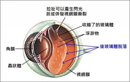玻璃體視網膜,希瑪瑞視眼科,上海眼科醫院 玻璃體視網膜,希瑪瑞視眼科,上海眼科醫院
