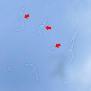 玻璃體視網(wǎng)膜,希瑪瑞視眼科,上海眼科醫(yī)院 玻璃體視網(wǎng)膜,希瑪瑞視眼科,上海眼科醫(yī)院