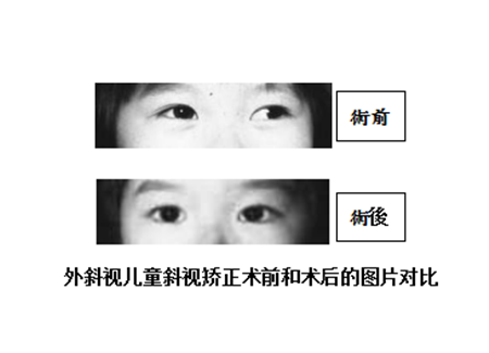 小兒眼病,希瑪瑞視眼科,上海眼科醫(yī)院 小兒眼病,希瑪瑞視眼科,上海眼科醫(yī)院
