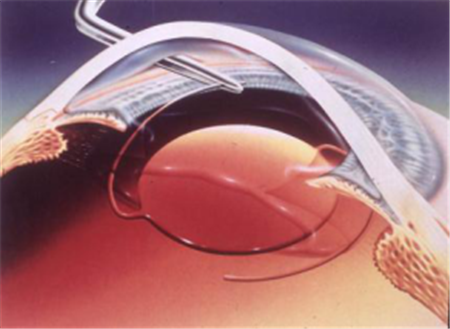 小兒眼病,?，斎鹨曆劭?上海眼科醫院