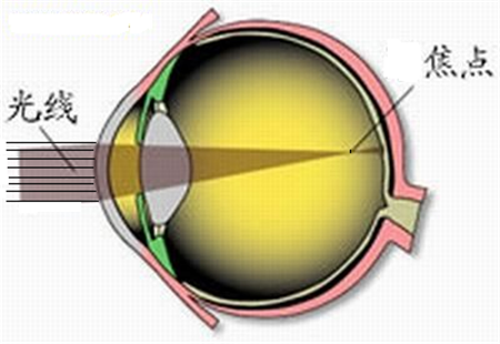 小兒眼病,希瑪瑞視眼科,上海眼科醫院 小兒眼病,希瑪瑞視眼科,上海眼科醫院