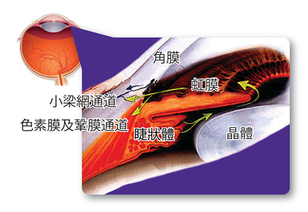 青光眼,希瑪瑞視眼科,上海眼科醫(yī)院 青光眼,希瑪瑞視眼科,上海眼科醫(yī)院