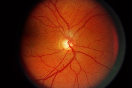 眼表眼角膜,希瑪瑞視眼科,上海眼科醫院