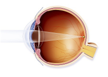 玻璃體視網膜,希瑪瑞視眼科,上海眼科醫院