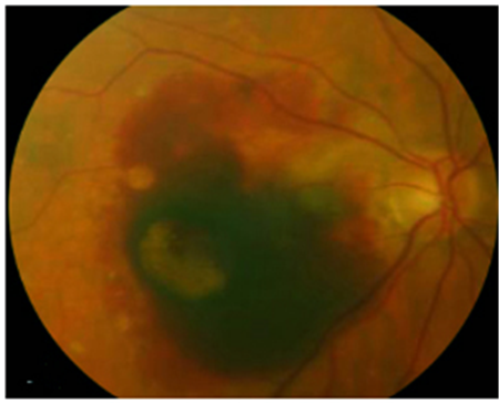 眼表眼角膜,希瑪瑞視眼科,上海眼科醫院 眼表眼角膜,希瑪瑞視眼科,上海眼科醫院