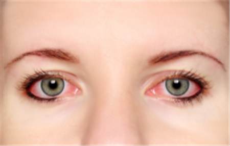 眼表眼角膜,希瑪瑞視眼科,上海眼科醫院