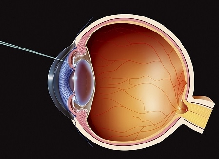 眼表眼角膜,希瑪瑞視眼科,上海眼科醫(yī)院