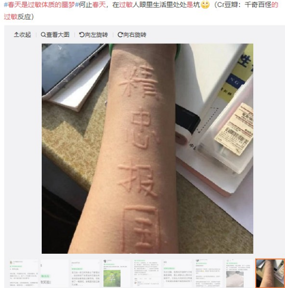 眼表眼角膜,希瑪瑞視眼科,上海眼科醫院