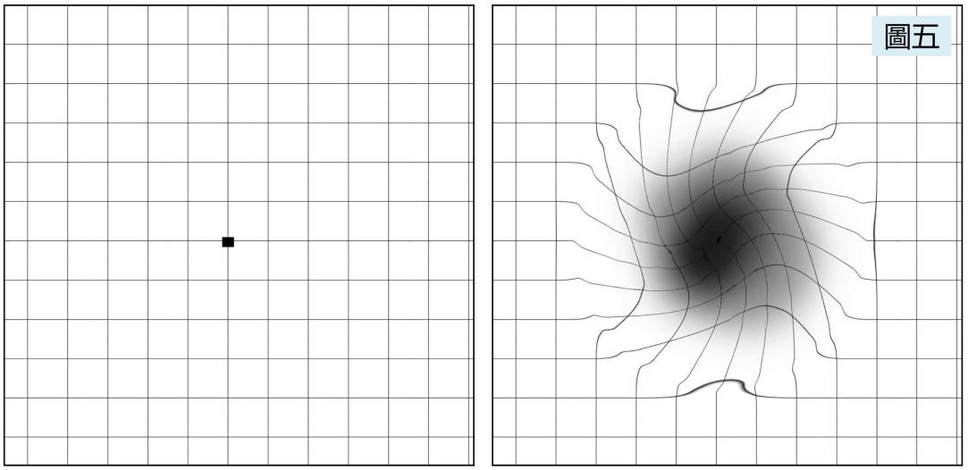 玻璃體視網(wǎng)膜,希瑪瑞視眼科,上海眼科醫(yī)院 玻璃體視網(wǎng)膜,希瑪瑞視眼科,上海眼科醫(yī)院