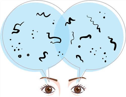 玻璃體視網膜,希瑪瑞視眼科,上海眼科醫院 玻璃體視網膜,希瑪瑞視眼科,上海眼科醫院