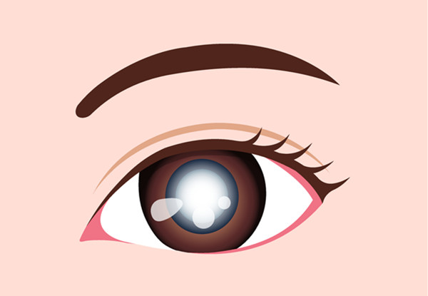 小兒眼病,希瑪瑞視眼科,上海眼科醫(yī)院