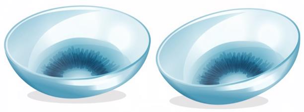 醫學驗光配鏡,希瑪瑞視眼科,上海眼科醫院