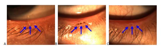 眼眶病,希瑪瑞視眼科,上海眼科醫院 眼眶病,希瑪瑞視眼科,上海眼科醫院